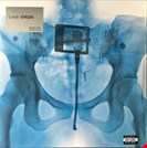 Lorde Virgin (Blood Vinyl) Universal
